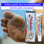 Load image into Gallery viewer, Crème pour les pieds diabétiques: Formule approuvée par des dermatologues Américains
