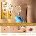 Load image into Gallery viewer, Spray anti-verrues: Fini les verrues, retrouvez confiance en vous